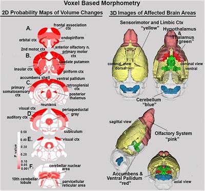 Chronic exposure to inhaled vaporized cannabis high in Δ9-THC alters brain structure in adult female mice